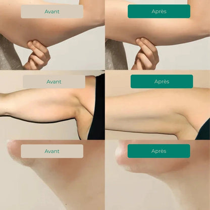 DRAINANT LYMPHATIQUE