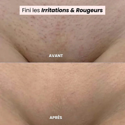 La solution douce pour toutes les zones sensibles