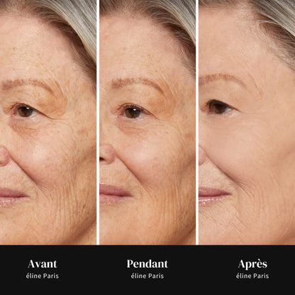 Elyane™ - Lisseur de Rides