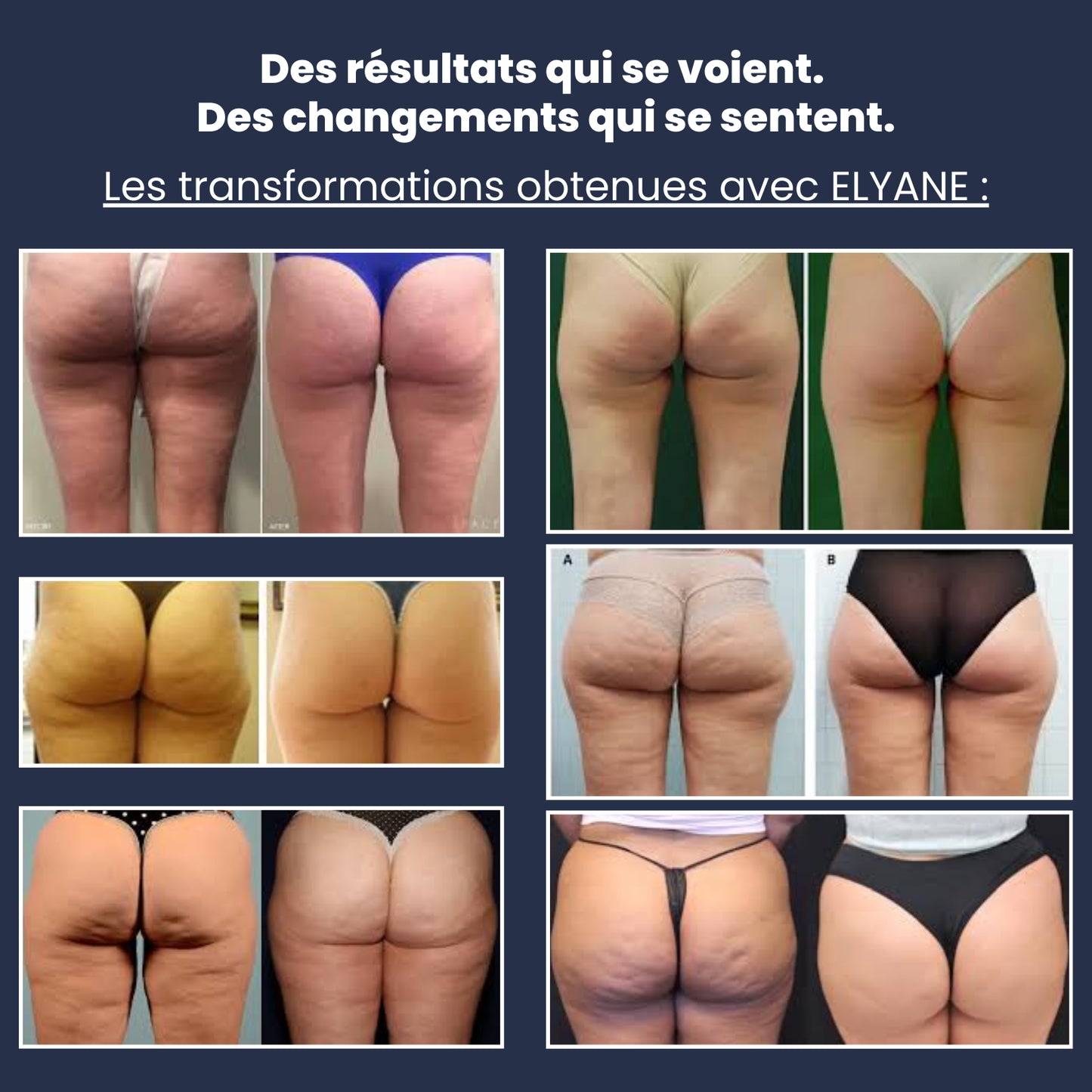 Legging 3D Anti-Cellulite
