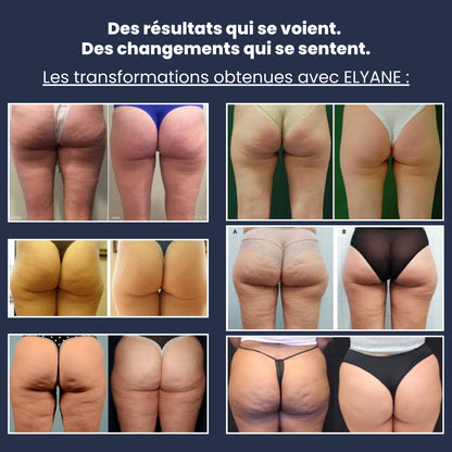Legging 3D Anti-Cellulite