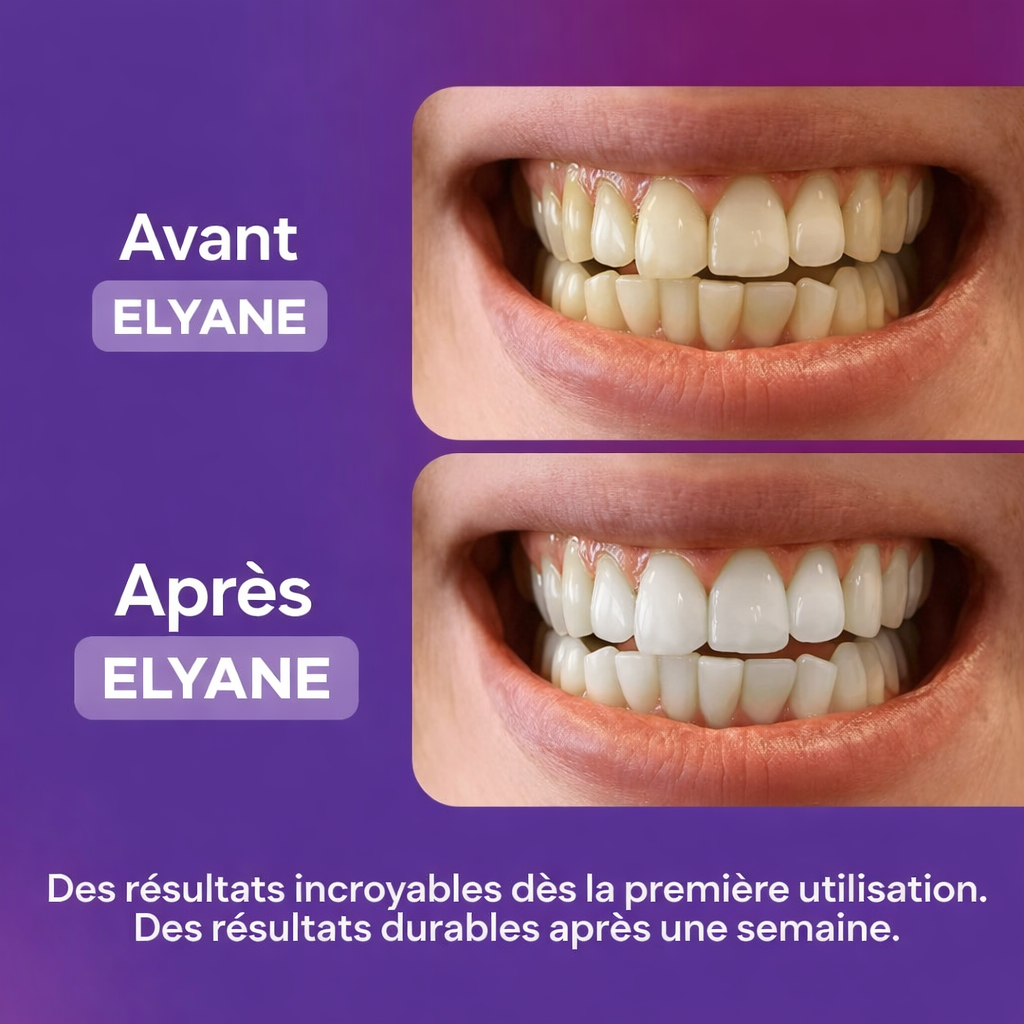 Bandes blanchissantes - Elyane