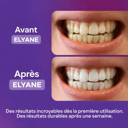Bandes blanchissantes - Elyane
